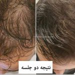 کوکتل رشد مو