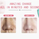 خرید اتو پوست