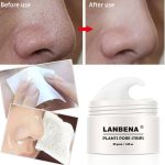 چسب از بین برنده جوش سر سیاه بینی